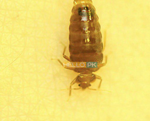Fumigation, Pest Control, Deemak, Khatmal, Lalbaig