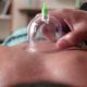 Hijama cure Cervical Pain Stiff Muscles Anxiety,Allergies Hair,Skin Problems