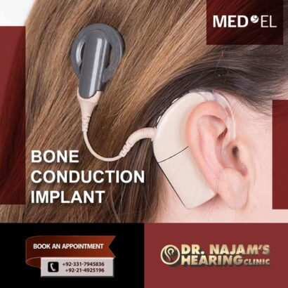 Medel Cochlear Implant Cost In Pakistan