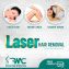 Laser Hair Removal Clinic in Islamabad – Full body Laser hair Removal