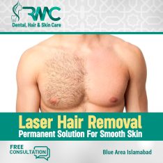 Laser Hair Removal Clinic in Islamabad – Full body Laser hair Removal