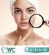 Laser Treatment For Acnes cars in Islamabad – Acnes cars Removal | RMC