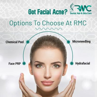 Laser Treatment For Acnes cars in Islamabad – Acnes cars Removal | RMC