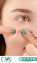 Laser Treatment For Acnes cars in Islamabad – Acnes cars Removal | RMC
