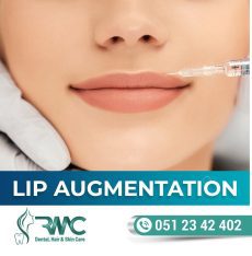 Lip Filler Treatment in Islamabad, Lip Fillers Injections In Islamabad