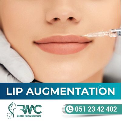 Lip Filler Treatment in Islamabad, Lip Fillers Injections In Islamabad