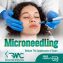 Microneedling Therapy in Islamabad-Best Microneedling Treatment I RMC
