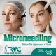 Microneedling Therapy in Islamabad-Best Microneedling Treatment I RMC