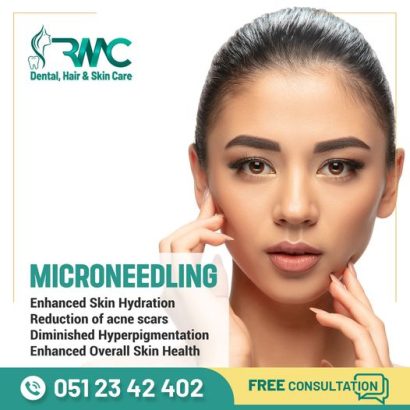 Microneedling Therapy in Islamabad-Best Microneedling Treatment I RMC