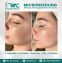 Microneedling Therapy in Islamabad-Best Microneedling Treatment I RMC