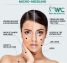 Microneedling Therapy in Islamabad-Best Microneedling Treatment I RMC