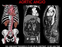 Toshiba Asteion Super 4 Slice Ct Scan ( 2023 Deal In Just 12 Million )
