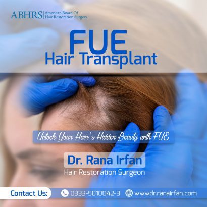 Hair transplant services in Pakistan
