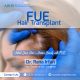Hair transplant services in Pakistan