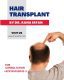 Best hair treatment in Islamabad