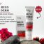 Reco Derm Anti- Acne Cream