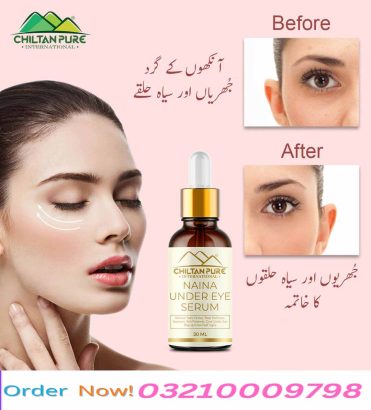 Naina Under Eye Serum in Pakistan | Lahore