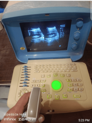 Ultrasound Machine for sale, Contact