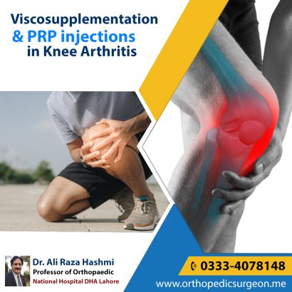 Joint replacement in Lahore