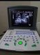 NOVADEX N9 DIGITAL BATTERY OPRATED ULTRASOUND MACHINE
