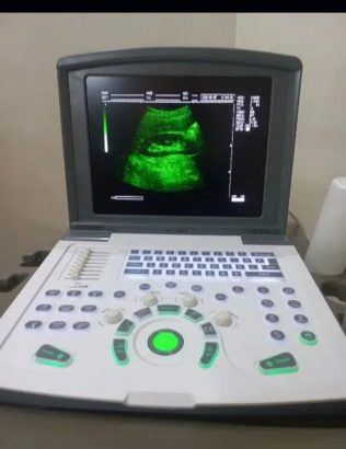 NOVADEX X N9 DIGITAL BATTERY OPRATED ULTRASOUND. MACHINE