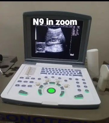 NOVADEX X N9 DIGITAL BATTERY OPRATED ULTRASOUND. MACHINE