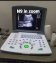 NOVADEX X N9 DIGITAL BATTERY OPRATED ULTRASOUND. MACHINE