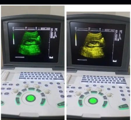 NOVADEX N9 DIGITAL BATTERY OPRATED ULTRASOUND MACHINE