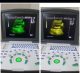 NOVADEX N9 DIGITAL BATTERY OPRATED ULTRASOUND MACHINE